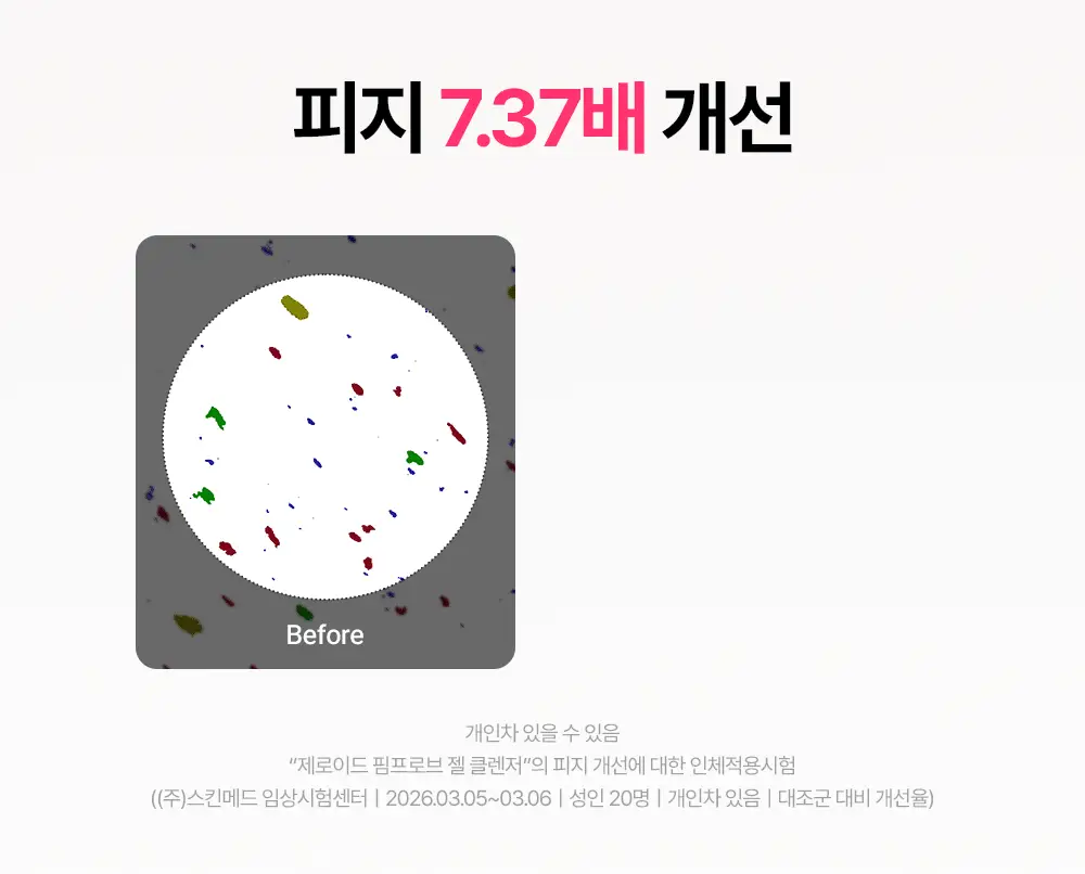 [트러블 피부 추천/여드름균 항균 클렌징] 제로이드 핌프로브 젤 클렌저 180ml 상세페이지 20